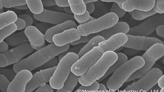 صورة لبكتيريا في أمعاء انسان