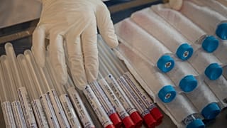 En esta foto del 1 de abril de 2020, un trabajador humanitario de la ONG española Open Arms toca kits de prueba de detección de coronavirus en un hogar de ancianos.
