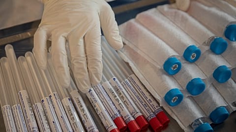 En esta foto del 1 de abril de 2020, un trabajador humanitario de la ONG española Open Arms toca kits de prueba de detección de coronavirus en un hogar de ancianos.