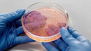 صورة لطبق بتري يحتوي على عينة من كائنات دقيقة