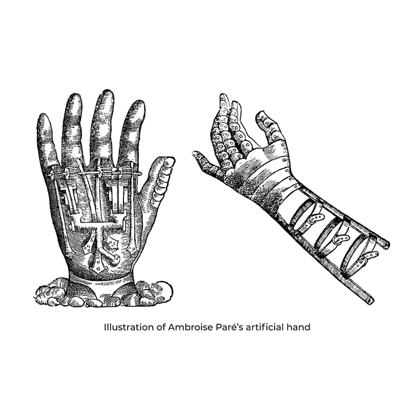 The FFC's design draws from the work of 16th-century surgeon Ambroise Paré