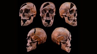 Margaret Adası'ndaki 13. yüzyıldan kalma iskeletin kafatası