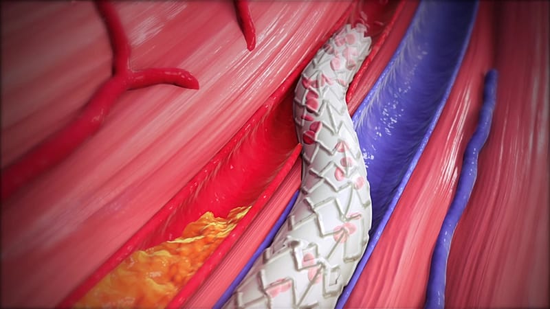 اكتشاف طبي نوعي: بروتين مرتبط بالسرطان يساهم في تسريع التئام الجروح 