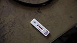 Un test per la malaria indica un risultato positivo in una clinica a Hamdayet, nel Sudan orientale, vicino al confine con l'Etiopia, il 17 marzo 2021.