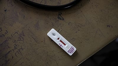 Un test de dépistage du paludisme indique un résultat positif dans une clinique à Hamdayet, à l'est du Soudan, près de la frontière avec l'Éthiopie, le 17 mars 2021.