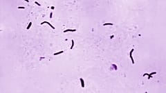 Microfotografia de 1966, fornecida pelo CDC dos EUA, mostra bacilos de Mycobacterium tuberculosis, o agente responsável pela tuberculose