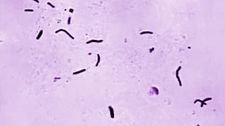 This 1966 microscope photo provided by the US CDC shows Mycobacterium tuberculosis bacilli, the organism responsible for causing the disease tuberculosis.