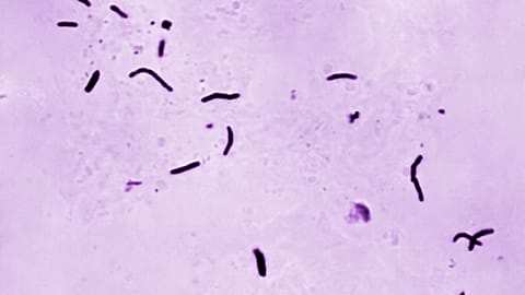 This 1966 microscope photo provided by the US CDC shows Mycobacterium tuberculosis bacilli, the organism responsible for causing the disease tuberculosis.