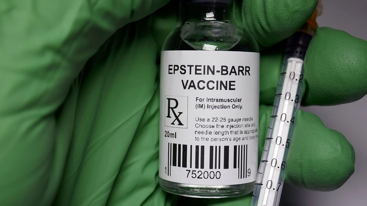 يقول العلماء إن فيروس إبشتاين-بار هو المحفز المرجح لمرض الذئبة