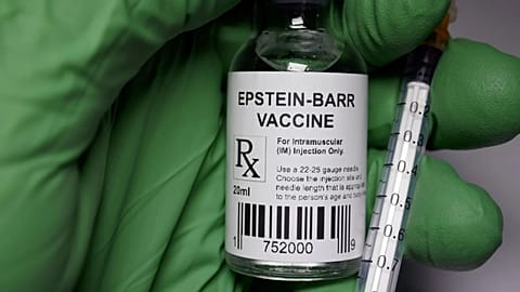 Epstein-Barr virus identified as likely trigger for lupus disease, scientists say