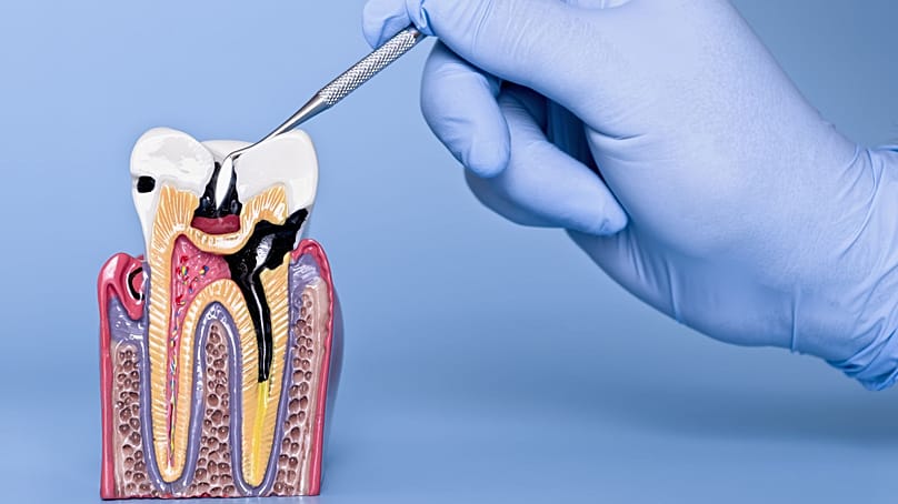 قسمت های مختلف دندان