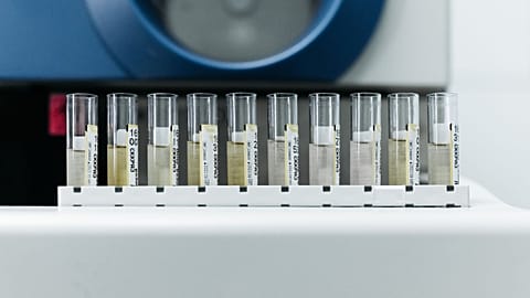 Samples are shown in test tubes in a lab.