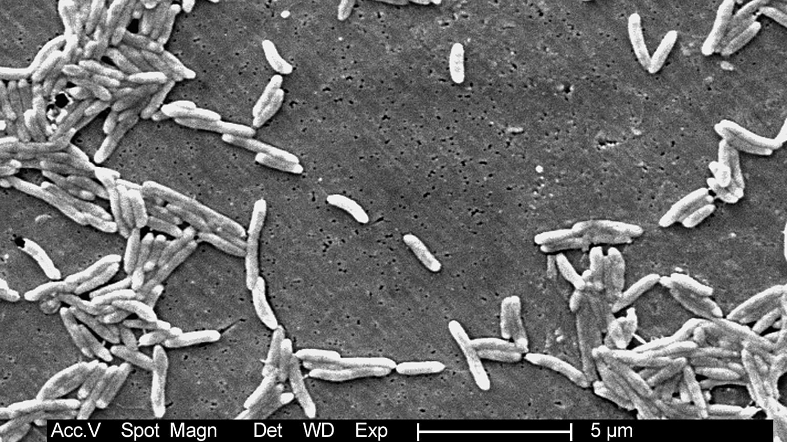 Dieses Elektronenmikroskopbild aus dem Jahr 2004, bereitgestellt vom Center for Disease Control and Prevention (CDC)zeigt gramnegative Campylobacter fetus-Bakterien.