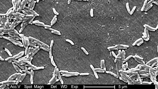 Ten mikrograf elektronowy z 2004 roku, dostarczony przez Centrum Kontroli i Zapobiegania Chorobom (CDC), przedstawia Gram-ujemne bakterie Campylobacter fetus.