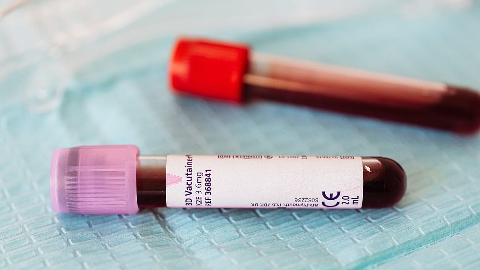 Kan testleri gösteriliyor.