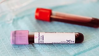 Blood tests are shown.