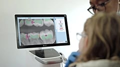 La detección de caries mediante IA en Second Opinion® for Kids ofrece a padres y pacientes jóvenes una visión más clara y amigable de los hallazgos dentales.