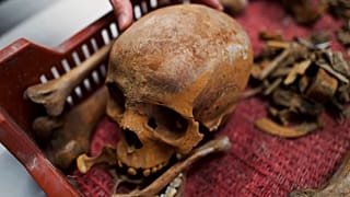 he skull of a Roman-era woman is seen in a box after archaeologists found the remains in an intact Roman sarcophagus, Wednesday, Nov. 19, 2025 in Budapest, Hungary