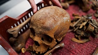 Roma dönemine ait kafatası.