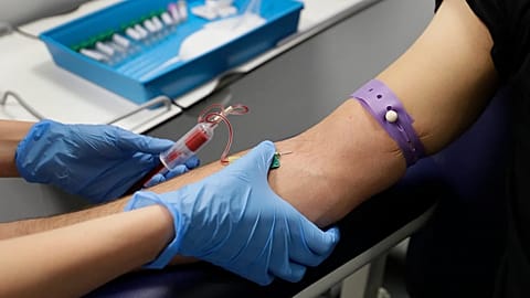 A total of 105,922 people in Europe were diagnosed with HIV in 2024.