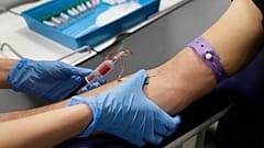 2024 yılında Avrupa'da toplam 105 bin 922 kişide HIV tespit edildi.