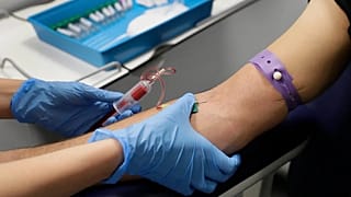 2024 yılında Avrupa'da toplam 105 bin 922 kişide HIV tespit edildi.