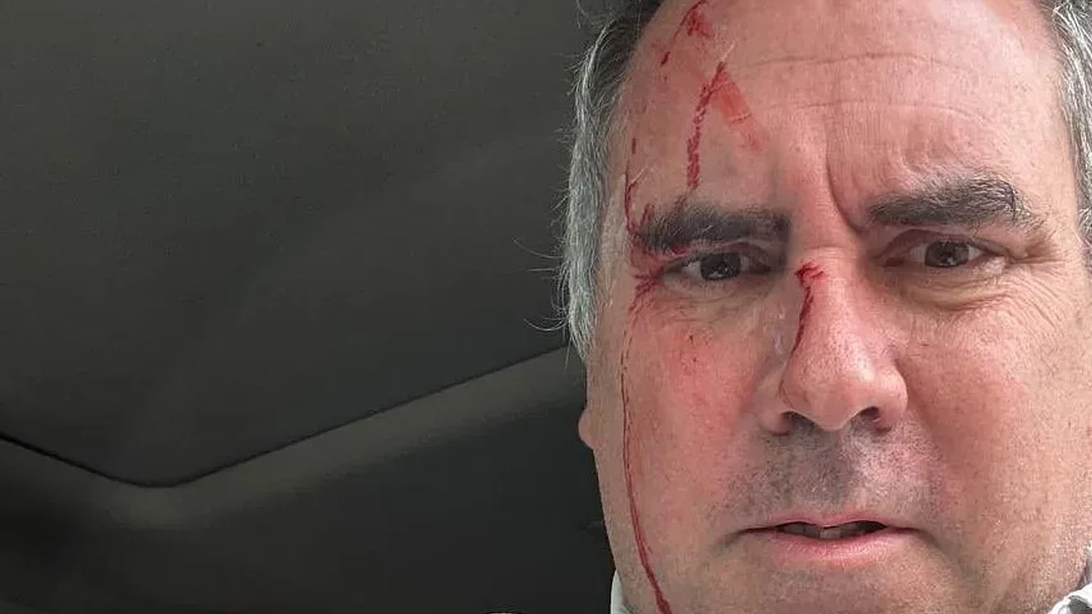 @CostaGino Excongresista. Autor de 'La Democracia Tomada' (IEP) en un post de X