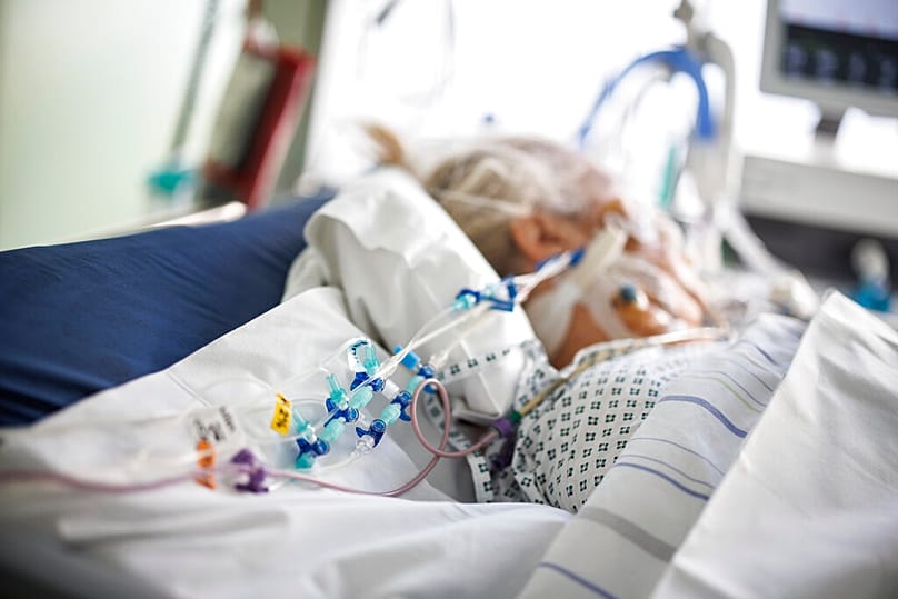 مريض يتلقى العلاج في وحدة العناية المركزة