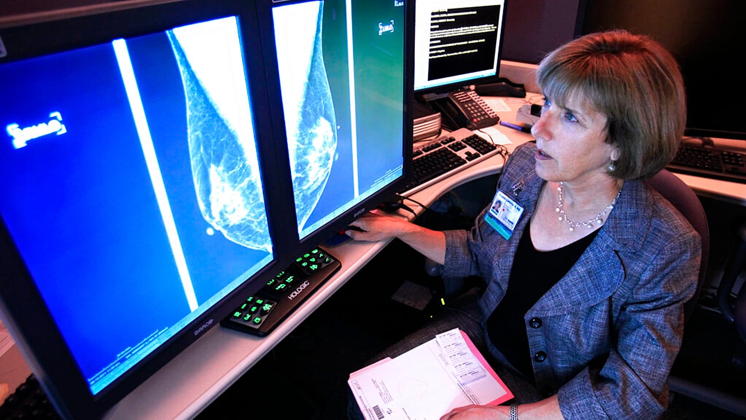 صورة تعبيرية- في هذه الصورة الملتقطة يوم الأربعاء 14 سبتمبر/أيلول 2011، تفحص الدكتورة كارين ليندسفور، أستاذة الأشعة ورئيسة قسم تصوير الثدي في المركز الطبي بجامعة كاليفورنيا في