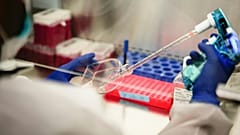 Zoliflodacin, das erste neue Antibiotikum, das seit Jahrzehnten ausschließlich für die Behandlung dieser Infektion entwickelt wurde, zielt auf die Bekämpfung arzneimittelresistenter Superbugs ab.