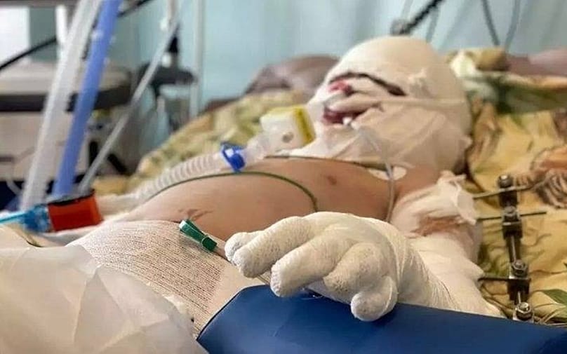 Roman Oleksziv a Drezdai Egyetemi Kórházban