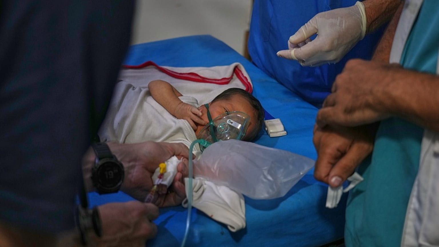 طفل يعاني من ��مى شديدة يتلقى العلاج في مستشفى ميداني في المواصي قرب خان يونس، جنوب قطاع غزة، في 27 سبتمبر 2025.