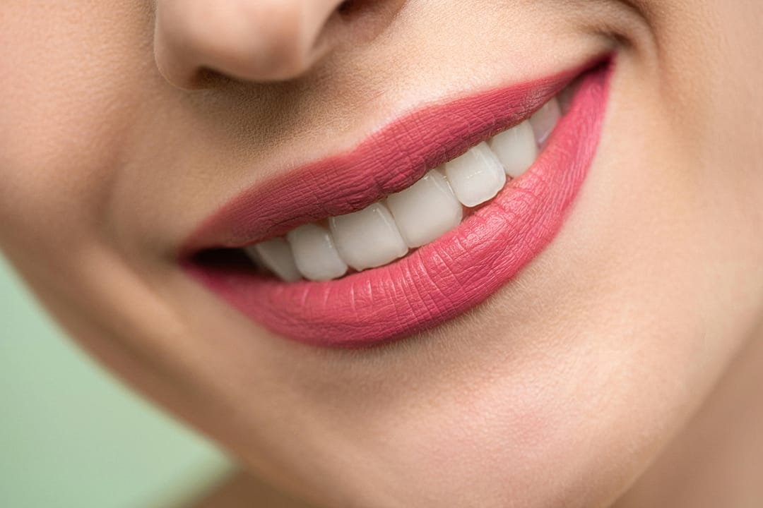 ماسکهای الایدی، آبهای غنیشده و غذاهای ضد میگرن: ترندهای سلامت ۲۰۲۵ در شبکههای اجتماعی 6 1080x720 cmsv2 aab9f614 c4f1 59c4 82bd 0a58cf61d859 9587765