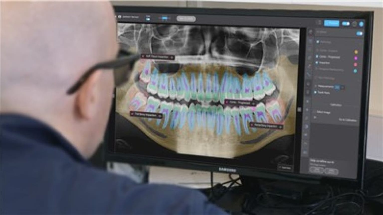يقوم طبيب أسنان بمراجعة صورة بانورامية بالأشعة السينية بمساعدة من برنامج Second Opinion® AI من شركة Pearl.