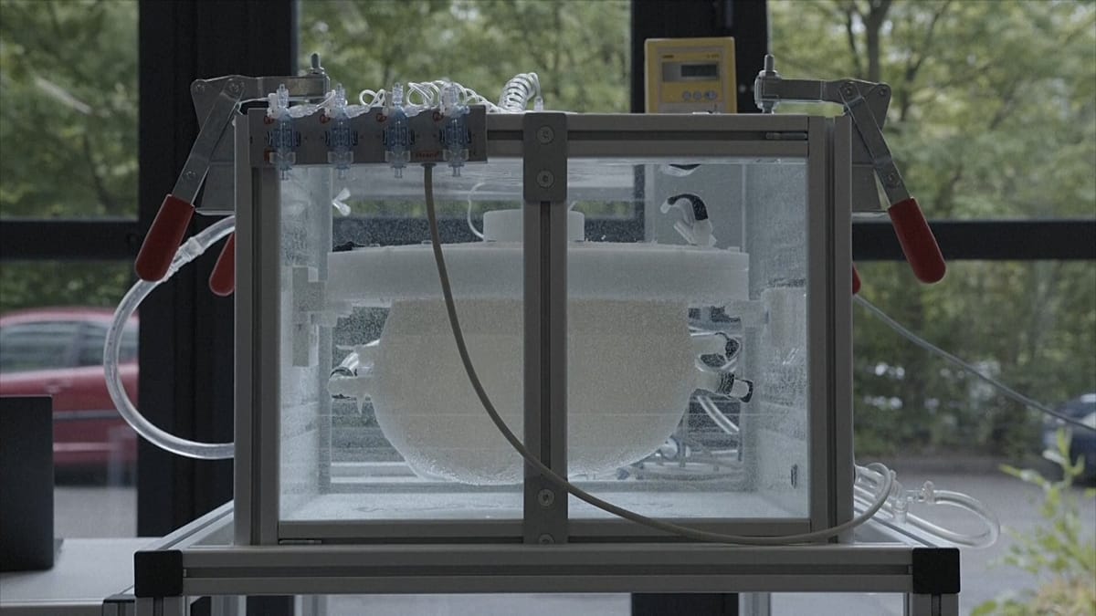 This ‘artificial womb’ could save the lives of very premature babies