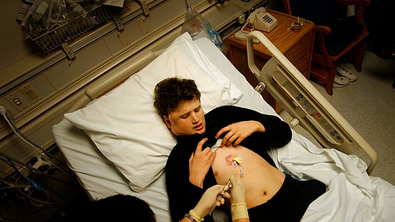 سرطان المعدة وبداياته الخفية.. دراسة علمية تكشف الآليات المبكرة للمرض 