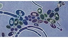 Candida auris temsili