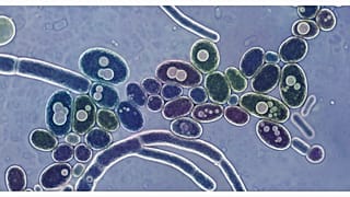 Candida auris temsili