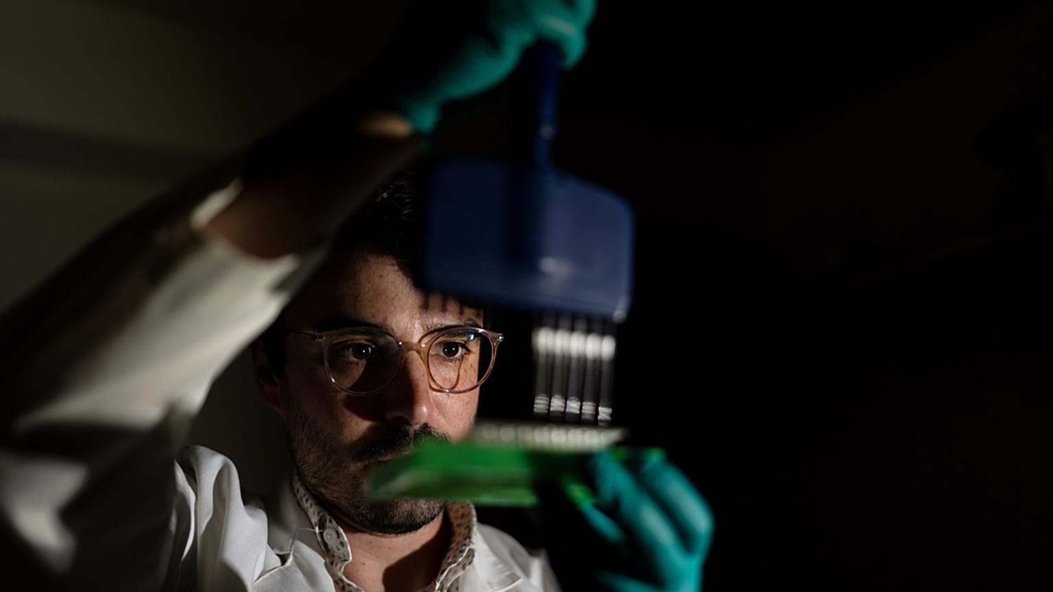 فحص دم في المختبر