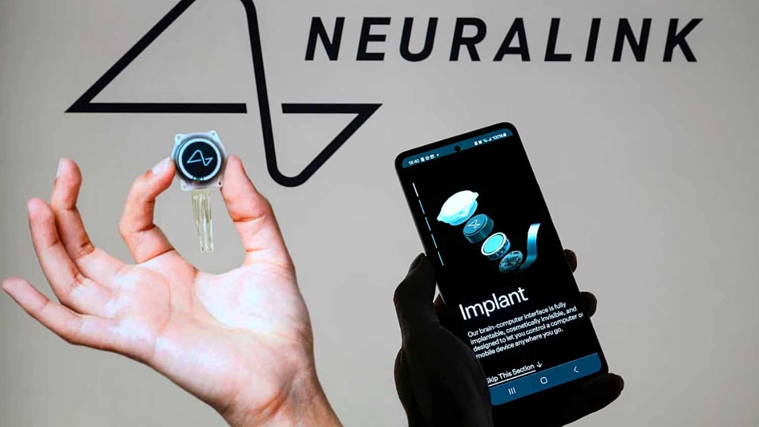 Neuralink