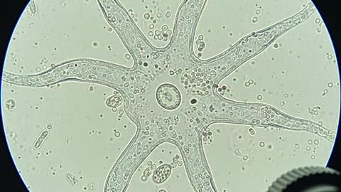 Bilim insanlarından amip uyarısı: 'Dünya genelinde su sistemlerine yayılıyor'