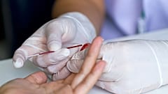 Según un nuevo estudio europeo, un sencillo análisis de sangre realizado en casa con la yema del dedo resulta prometedor para la detección precoz de la enfermedad de Alzheimer. 