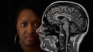 ًصورة لمسح دماغ مصابة