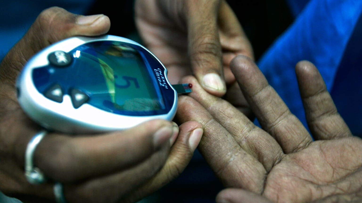 عاملة صحية، على اليسار، تأخذ عينة دم من يد مريض مصاب بالسكري في مخيم مجاني لفحص نسبة السكر في الدم بمناسبة اليوم العالمي للسكري في كلكتا، الهند، الجمعة 14 نوفمبر 2008