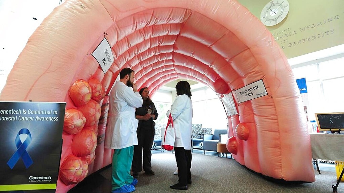 دراسة: تصلّب القولون المرتبط بالالتهاب يفسّر ارتفاع سرطان القولون المبكر لدى الشباب