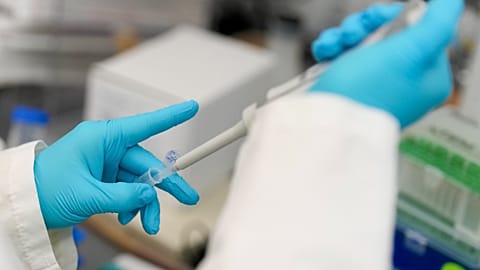 A student runs a test at Duke University pharmacology and cancer biology professor Donald McDonnell's lab Tuesday, March 4, 2025, in Durham, N.C. 