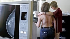 Forscher: KI-gestützte Brustkrebsfrüherkennung senkt in klinischer Studie Zahl fortgeschrittener Tumoren.