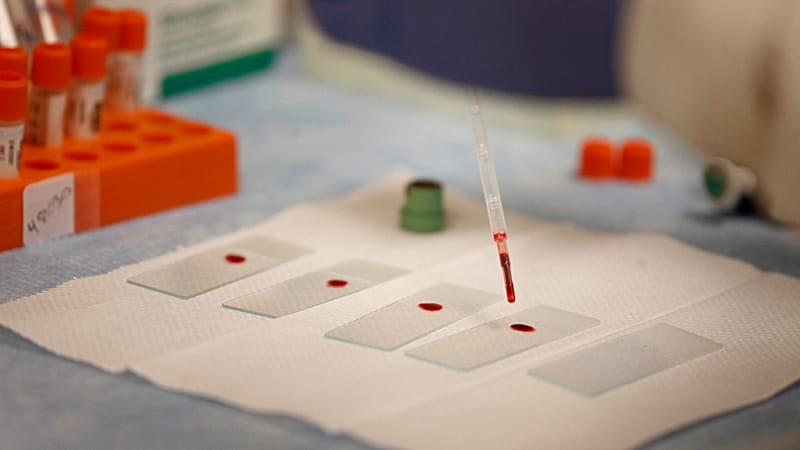 اختبار دم قد يساعد على اكتشاف سرطان البنكرياس قبل أن يصبح قاتلاً 