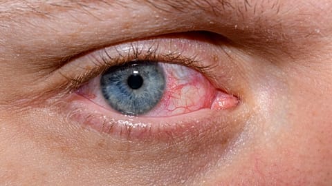 Как по глазам можно обнаружить болезнь Альцгеймера? Ученые установили неожиданную связь