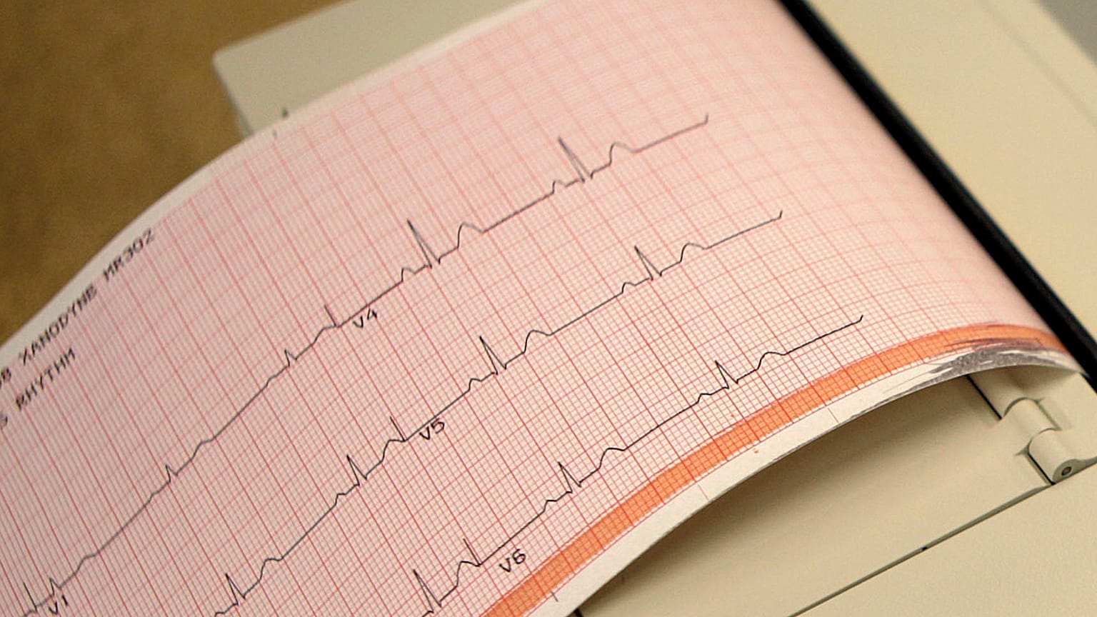 صورة تعبيرية لتخطيط قلب